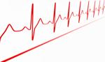 W I kw. '25 Medicalgorithmics przeprowadzi艂 ok. 92 tys. bada艅 EKG, czyli blisko 100 proc. wi臋cej rdr