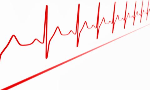 W I kw. '25 Medicalgorithmics przeprowadzi艂 ok. 92 tys. bada艅 EKG, czyli blisko 100 proc. wi臋cej rdr