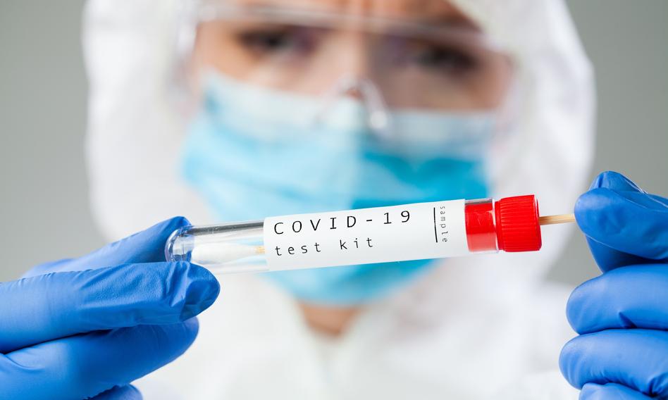 Ile kosztuje test na COVID-19?