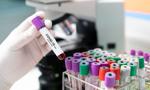 Sanepid zleca test na COVID-19 dla objętych opieką długoterminową