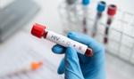 "Cichy kryzys" napędza epidemię. WHO ostrzega: Cel pokonania AIDS do 2030 r. jest zagrożony