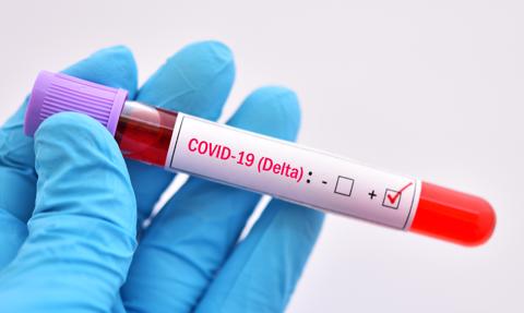 Wirusolog: zachorowań na COVID-19 nawet kilkanaście razy więcej, niż pokazują statystyki