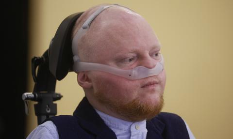 Stałe orzeczenia dla osób z rzadkimi chorobami genetycznymi. Rząd wprowadza zmiany